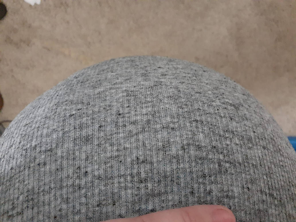pregnant women can't see their feet